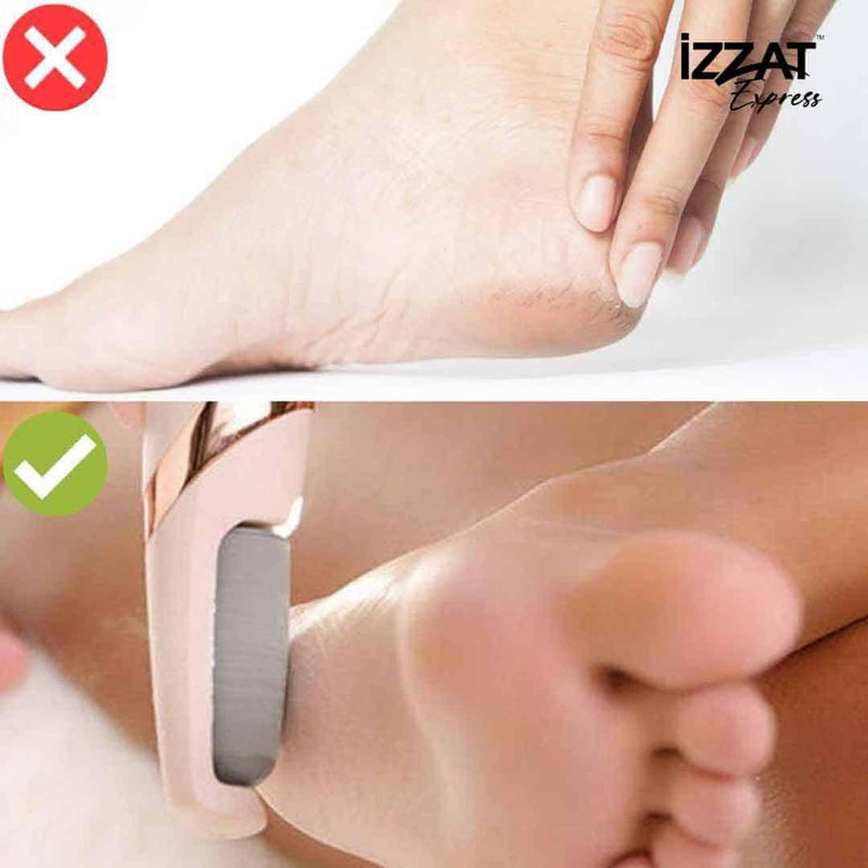 Lixa Elétrica Para os Pés Callus Soft™ - Removedor de Calos e Rachaduras