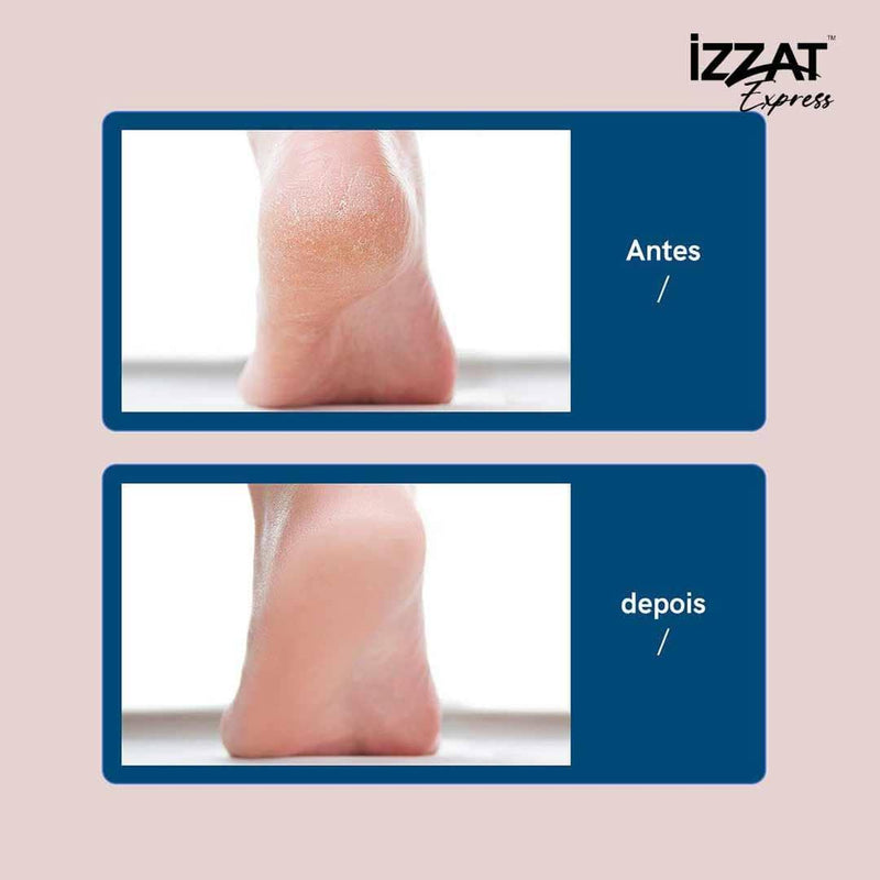 Lixa Elétrica Para os Pés Callus Soft™ - Removedor de Calos e Rachaduras